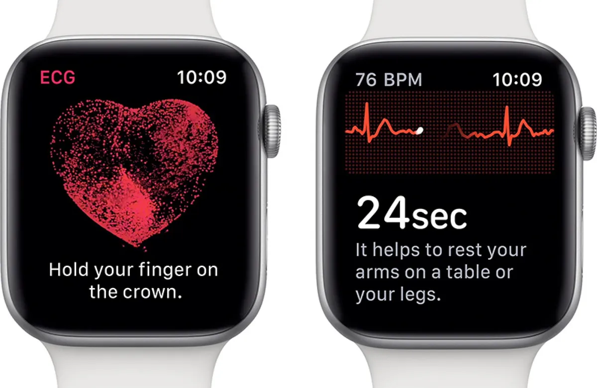 Apple watch monitoraggio cuore deals