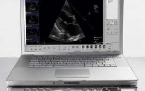 Acuson P50: Macbook Pro 
