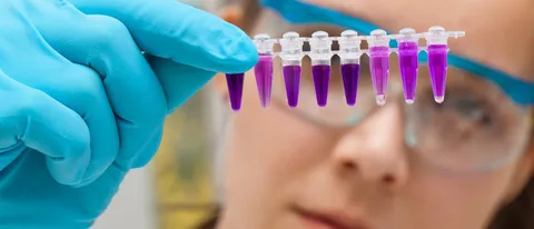 Google e Biogen Idec contro la sclerosi multipla