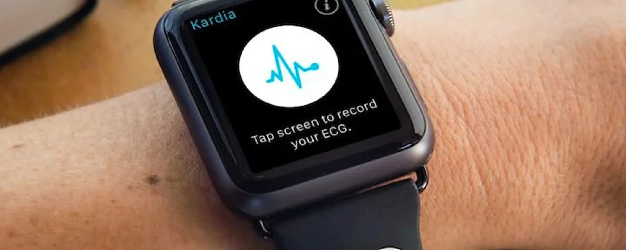 Apple ostacolerebbe le app di terze parti che monitorano il battito cardiaco