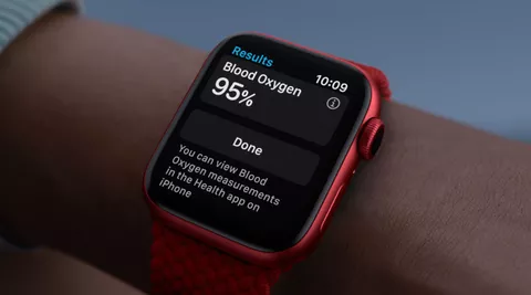 Masimo fa causa ad Apple per le tecnologie di salute di Apple Watch