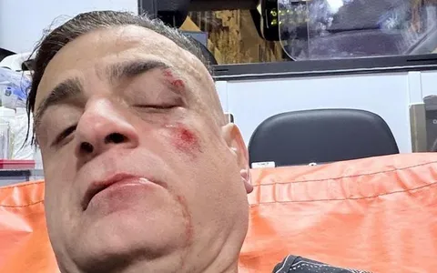 Aggressione a Simone Cicalone: lo YouTuber romano picchiato da dieci malviventi