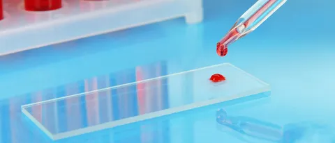 iWatch: il sensore di glucosio non ci sarà