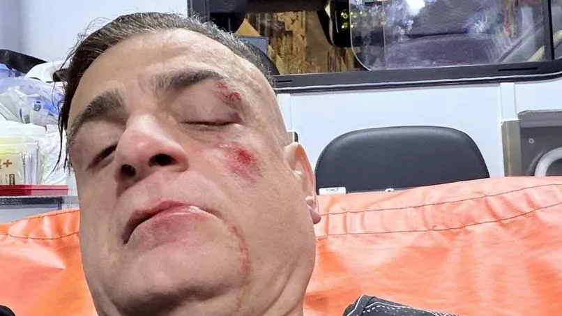 Aggressione a Simone Cicalone: lo YouTuber romano picchiato da dieci malviventi