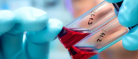 Google e AbbVie insieme per il progetto Calico