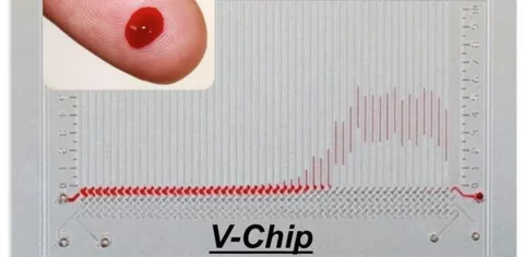 V-Chip, esami del sangue in pochi secondi