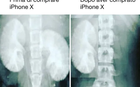 iPhone X, l'ironia degli utenti sul Web si prende gioco di Apple