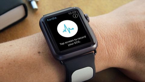 Apple Watch, diagnosi non invasiva degli eccessi di potassio