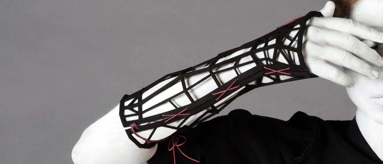 Edges: la protesi 3D tutta italiana