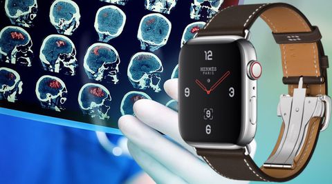 Apple Watch, diagnosi degli ictus in arrivo