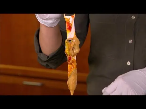 We destroyed the Apple Watch