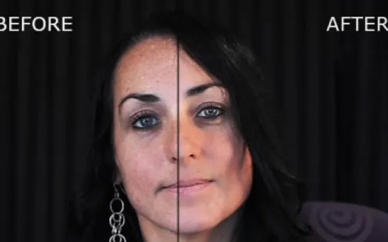 Beauty Box ritocca la pelle nelle foto