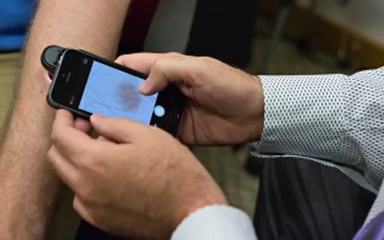 DermoScreen, l'app per iPhone che scopre i tumori ed è più precisa del vostro medico