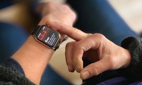 Apple Watch è un ECG portatile: salva un'altra vita