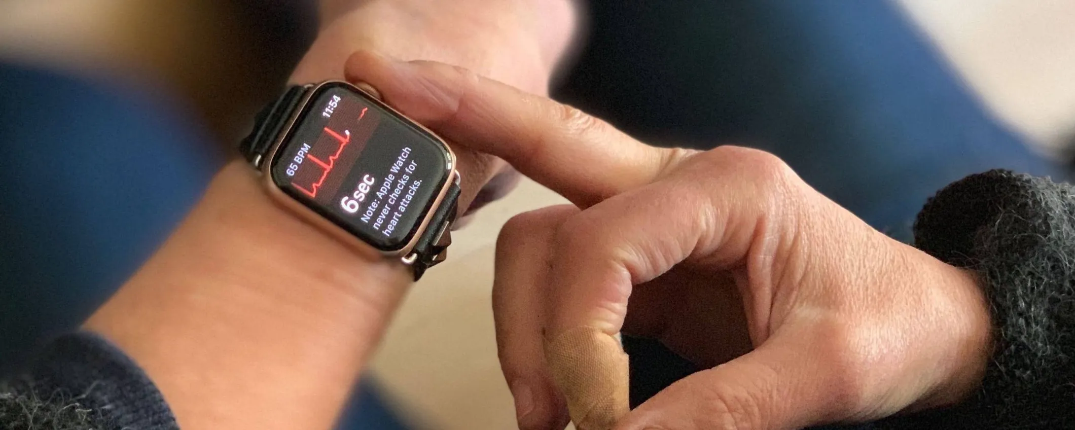 Apple Watch è un ECG portatile: salva un'altra vita