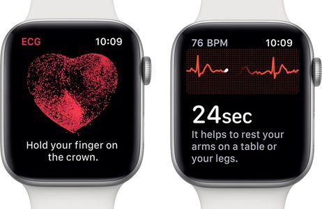 ECG su Apple Watch: ecco come funziona il monitoraggio cuore