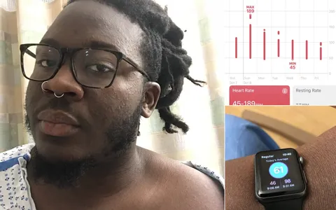 Apple Watch salva un uomo da embolia polmonare