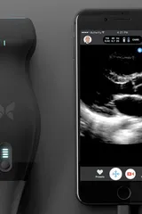 Chirurgo si auto-diagnostica un cancro con un accessorio per iPhone